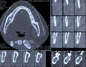 3D kompiuterinė tomografija odontologijoje