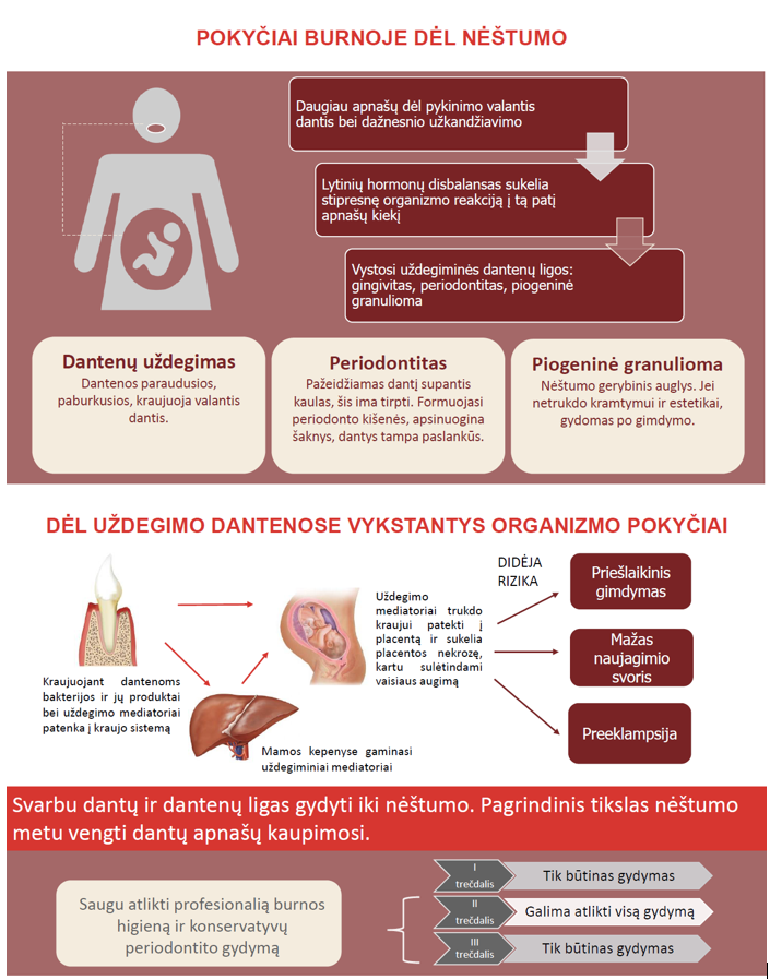 Nėščios moters burnos higienos rekomendacijos