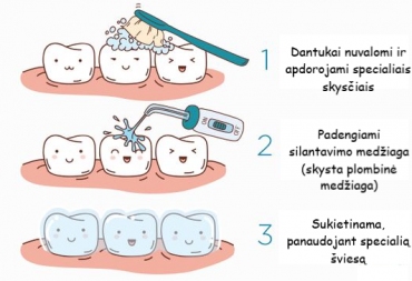 Dantų silantai