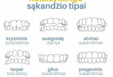 Vaikų sąkandžio problemos: kaip jas atpažinti ankstyvoje stadijoje?