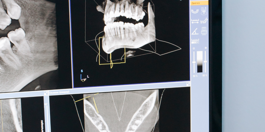 3D kompiuterinė tomografija