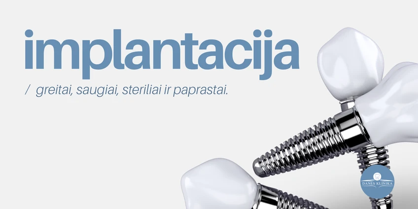 Dantų implantacija – greita, saugi ir paprasta procedūra