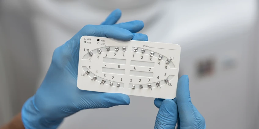 Kaip atpažinti netaisyklingą sąkandį?