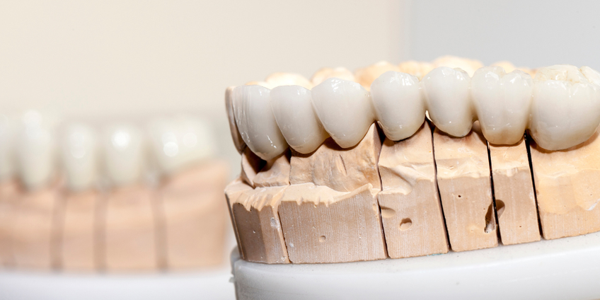 Protezavimas cirkonio keramika