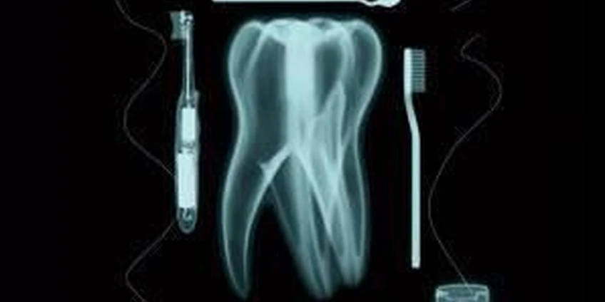 Rentgenologinis tyrimas endodontinio gydymo metu