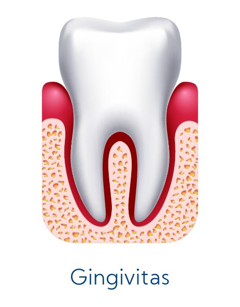 Periodontologija