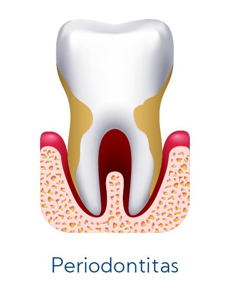 Periodontologija
